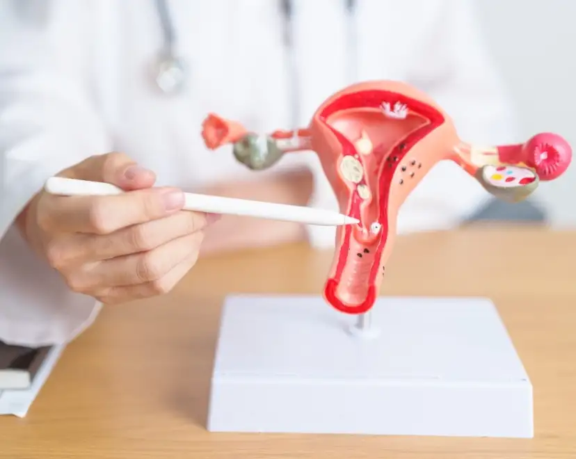 Endometriosis
