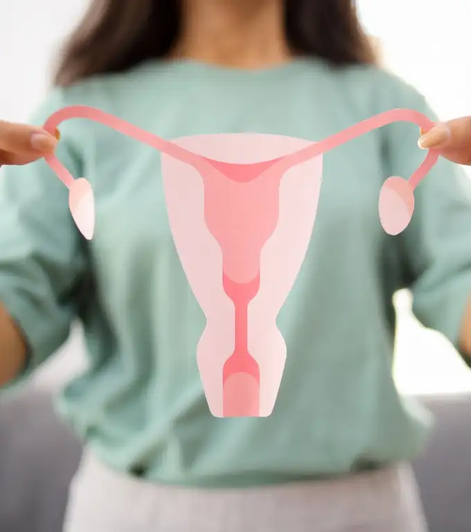 Polyendocrine Metabolic Ovarian Syndrome (PMOS)