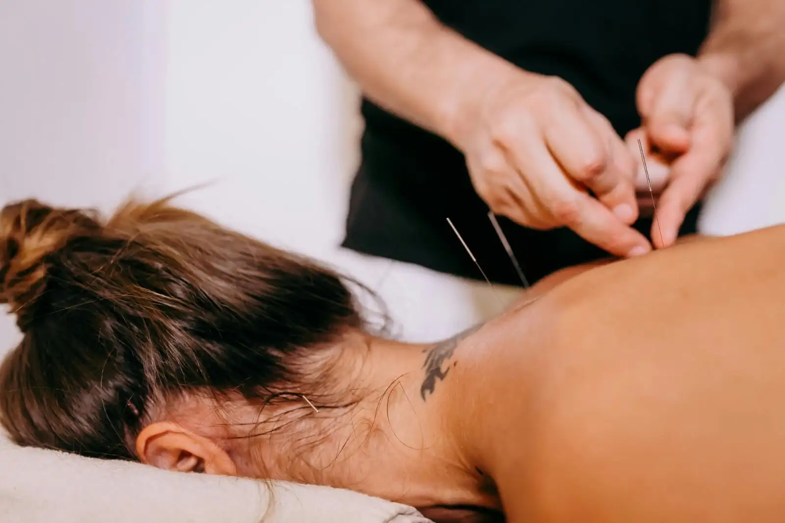 Acupuncture to Relieve Pain and Restore Balance